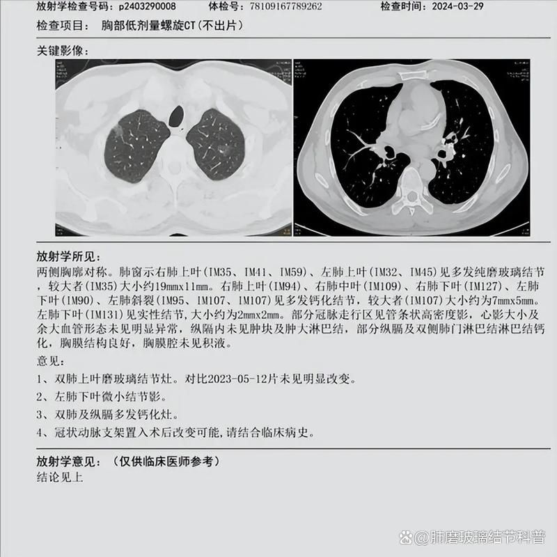 云南大理白族自治州现有本土确诊6例/云南大理州新型肺炎有几例