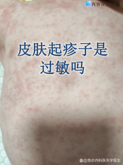 江苏省苏州市虎丘区昨日新增无症状感染者14例/虎丘区疫情