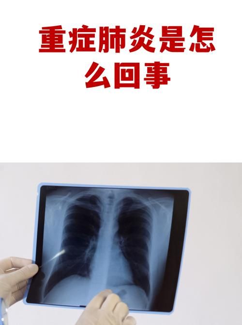 福建省龙岩市9月7日重症疫情通报/福建龙岩新冠肺炎疫情