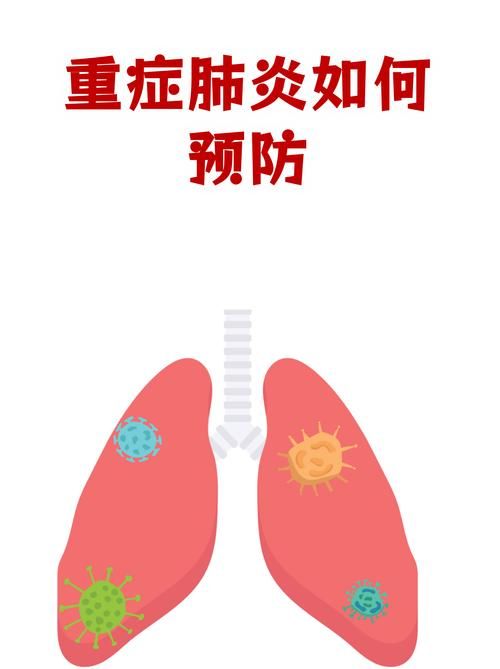 【四川省广安市岳池县昨日新增重症20例_四川省广安市岳池县新型肺炎】
