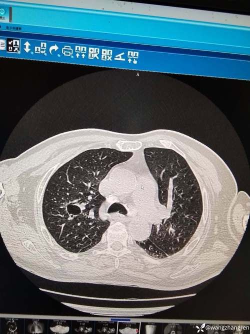 【桥西区累计报告核酸阳性7例,桥西区疫情】