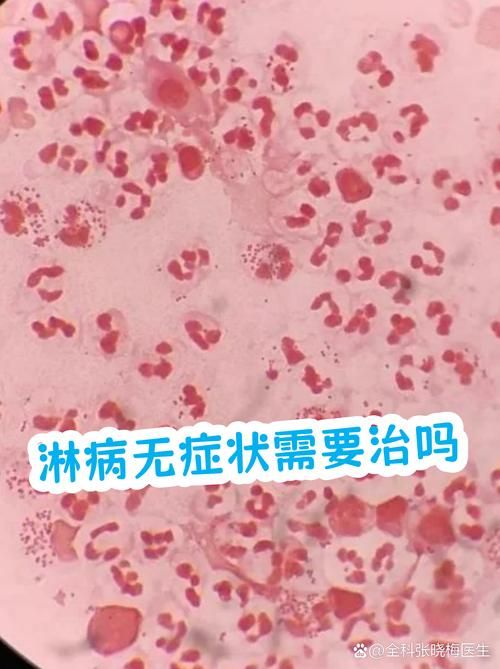 肥城市新增22例无症状感染者及18例无症状(肥城市新增22例无症状感染者及18例无症状病例)